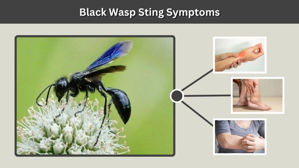 Black Wasp Sting Symptoms