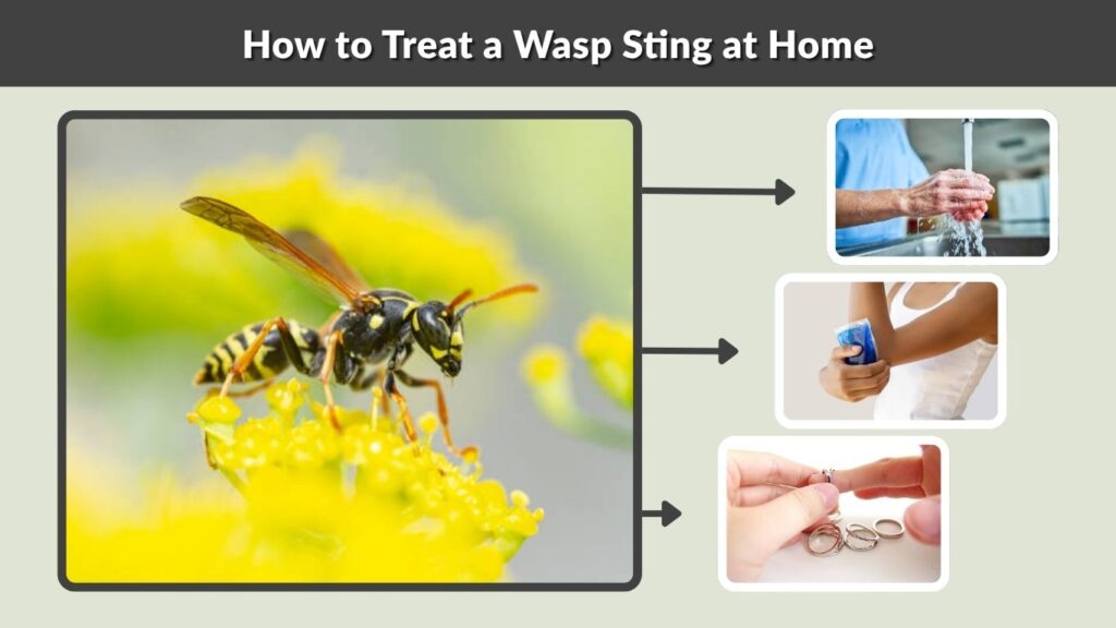 How to Treat a Wasp Sting at Home