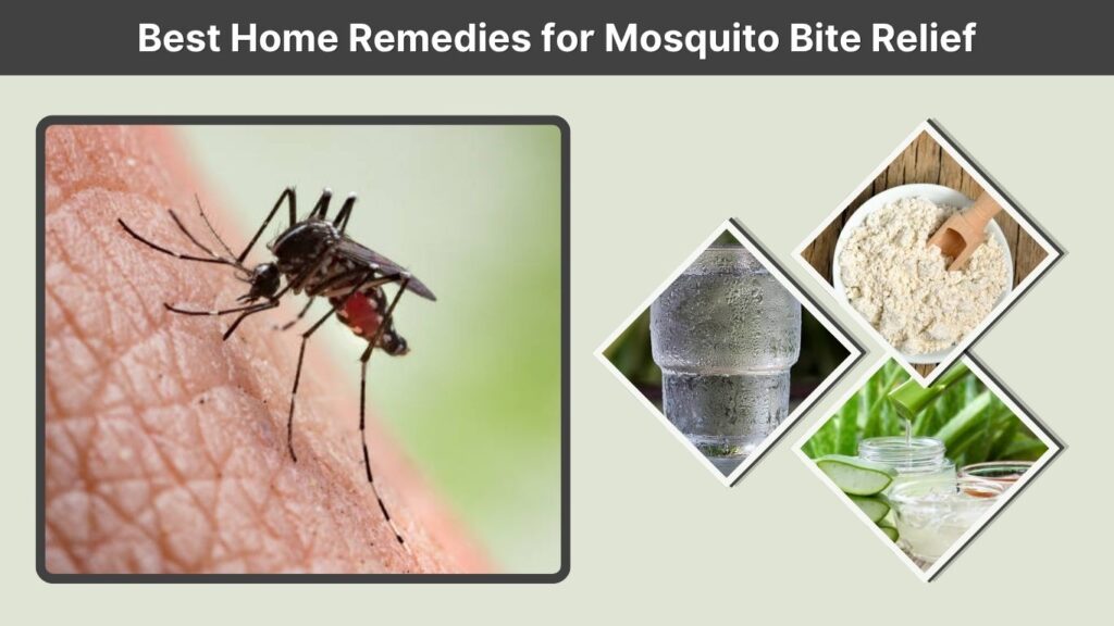 Best Home Remedies for Mosquito Bite Relief