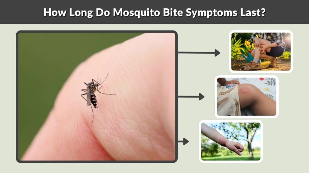 How Long Do Mosquito Bite Symptoms Last?