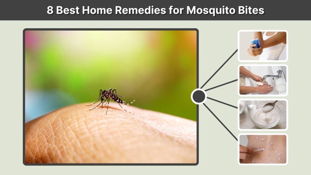 8 Best Home Remedies for Mosquito Bites