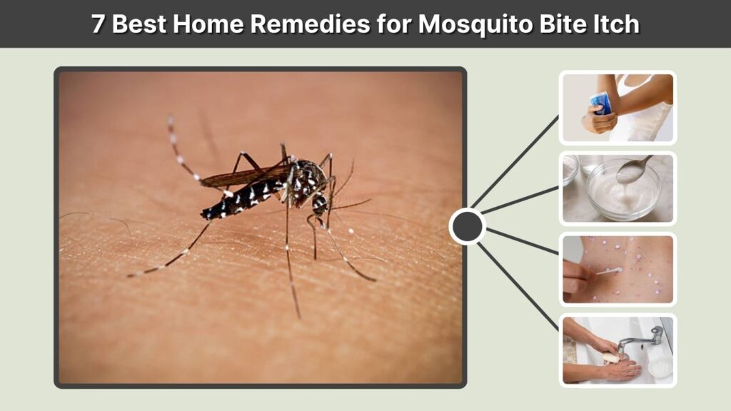 7 Best Home Remedies for Mosquito Bite Itch