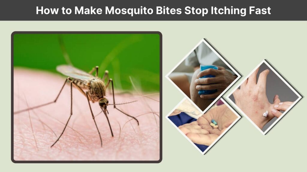 How to Make Mosquito Bites Stop Itching Fast