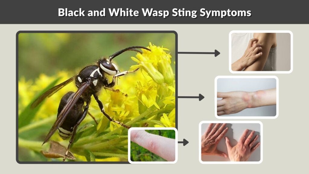 Black and White Wasp Sting Symptoms