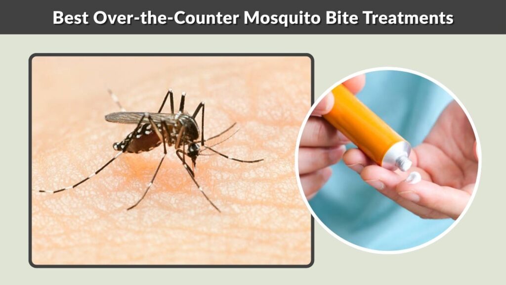 Best Over-the-Counter Mosquito Bite Treatments