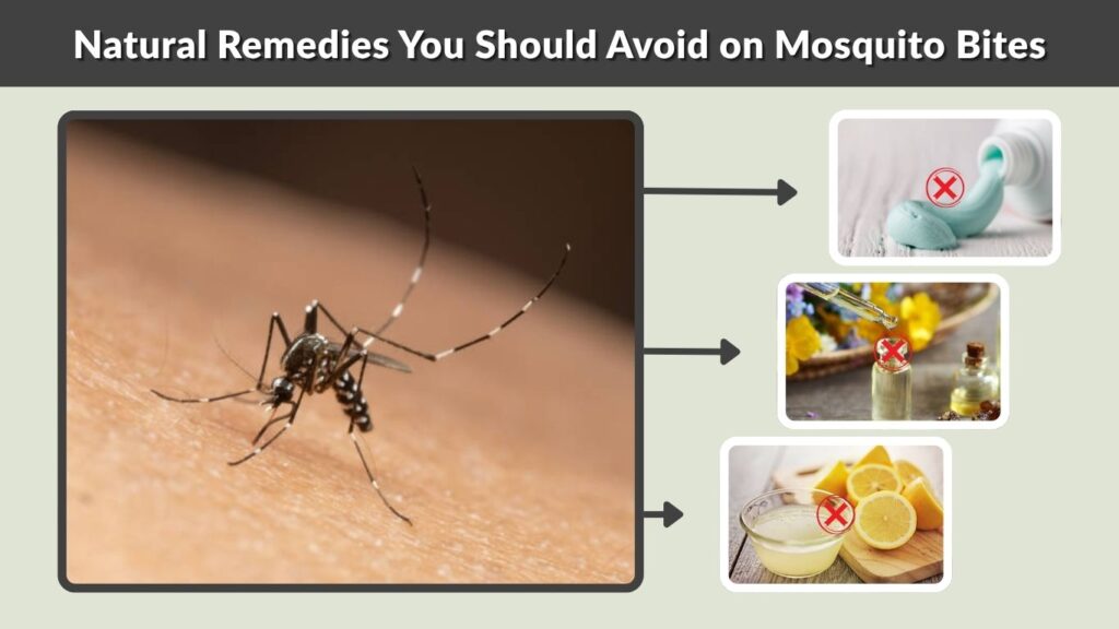 Natural Remedies You Should Avoid on Mosquito Bites