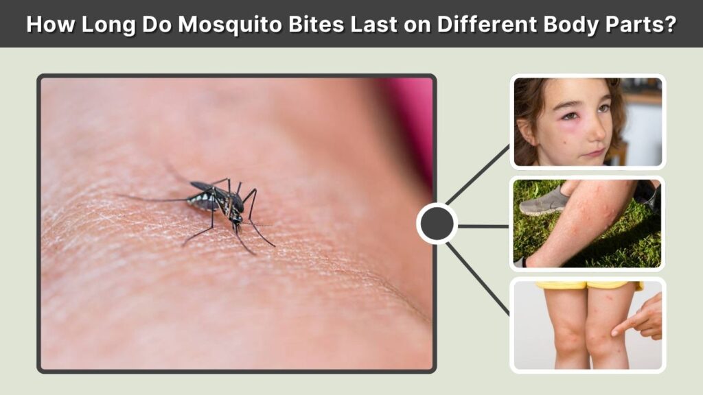 How Long Do Mosquito Bites Last on Different Body Parts?