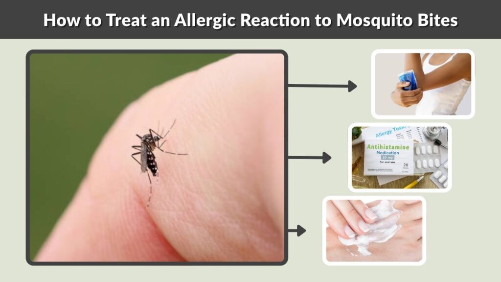 How to Treat an Allergic Reaction to Mosquito Bites