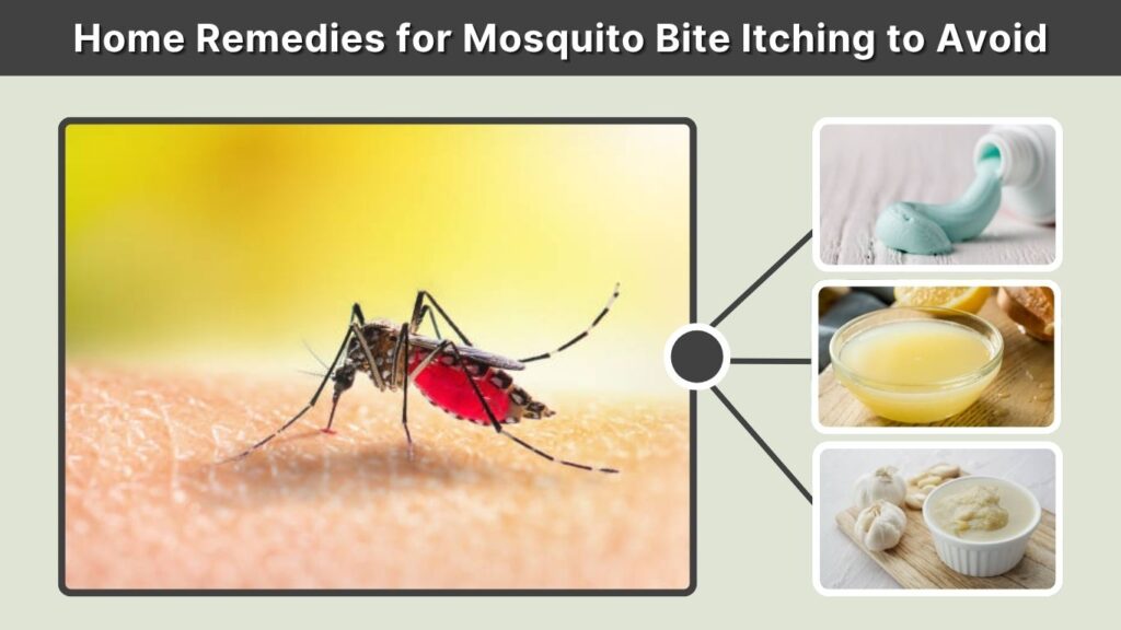 Home Remedies for Mosquito Bite Itching to Avoid