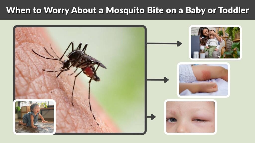 When to Worry About a Mosquito Bite on a Baby or Toddler