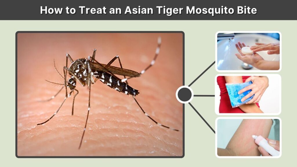 How to Treat an Asian Tiger Mosquito Bite