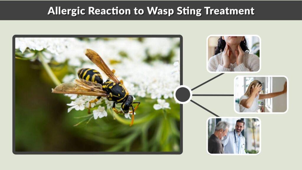 Allergic Reaction to Wasp Sting Treatment