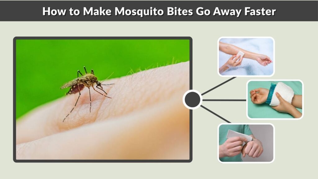 How to Make Mosquito Bites Go Away Faster