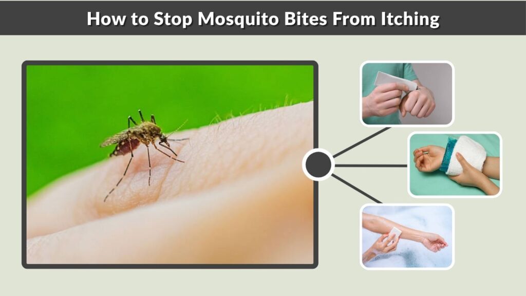 How to Stop Mosquito Bites From Itching