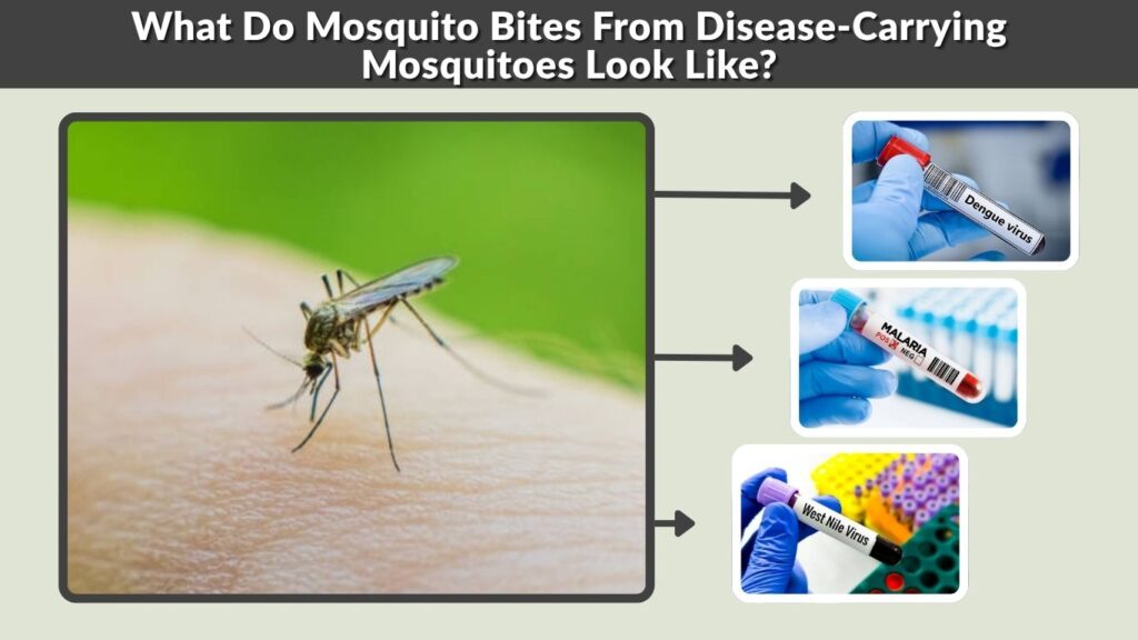 What Do Mosquito Bites From Disease-Carrying Mosquitoes Look Like?