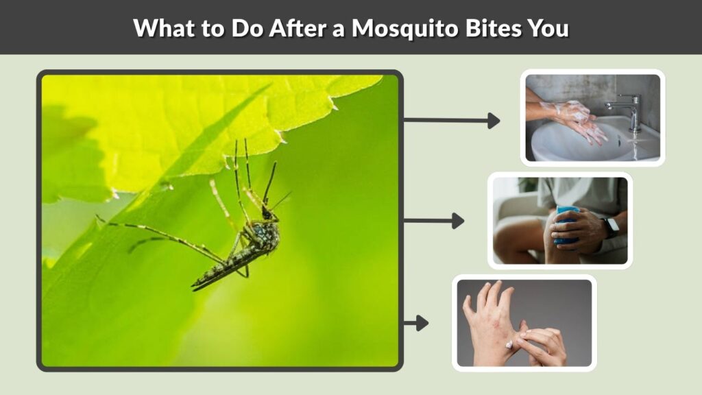 What to Do After a Mosquito Bites You
