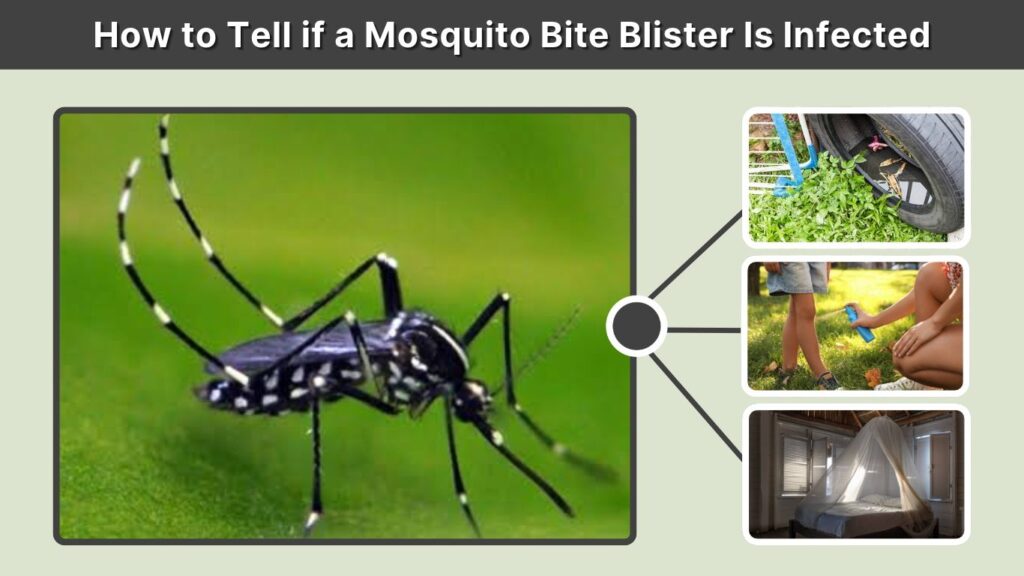 How to Tell if a Mosquito Bite Blister Is Infected
