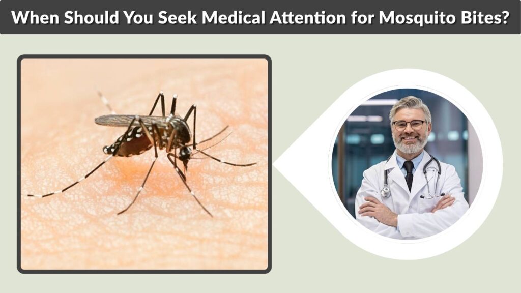 When Should You Seek Medical Attention for Mosquito Bites?