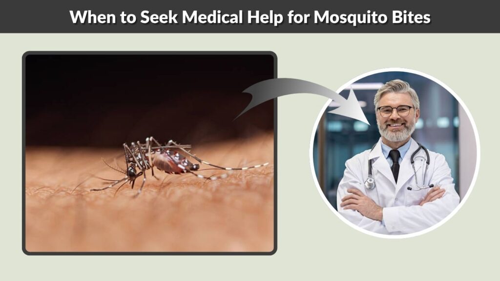 When to Seek Medical Help for Mosquito Bites