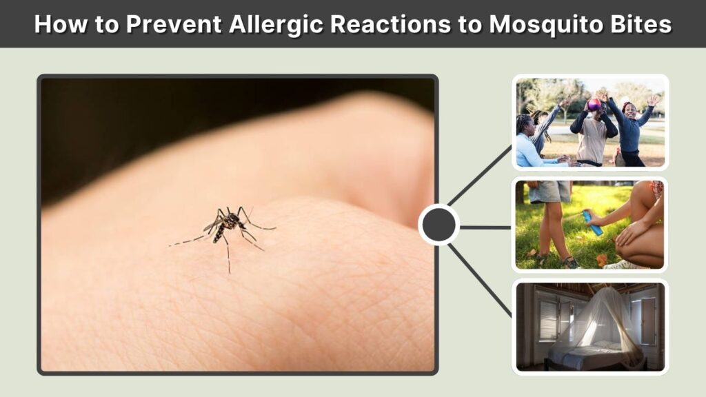 How to Prevent Allergic Reactions to Mosquito Bites