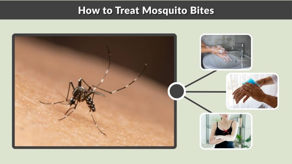 How to Treat Mosquito Bites