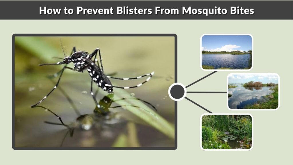 How to Prevent Blisters From Mosquito Bites
