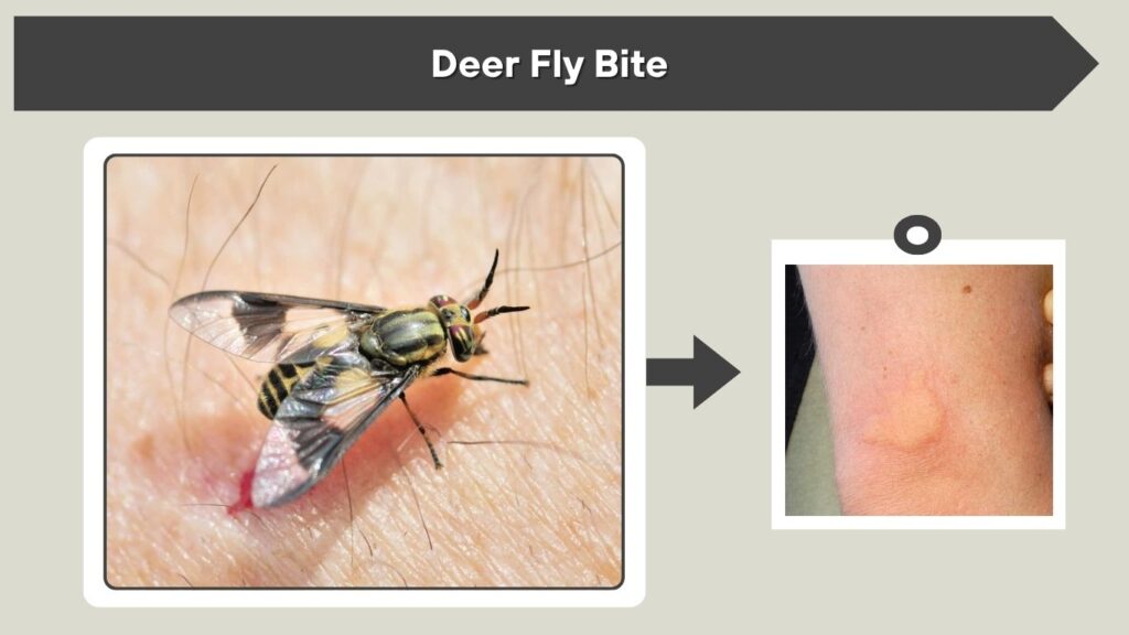 Deer Fly Bite