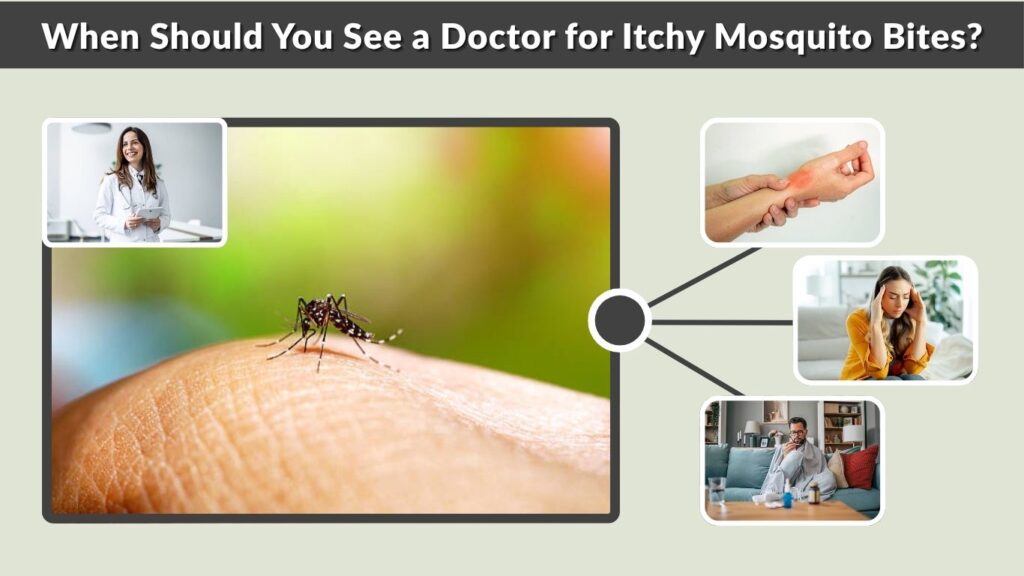 When Should You See a Doctor for Itchy Mosquito Bites?